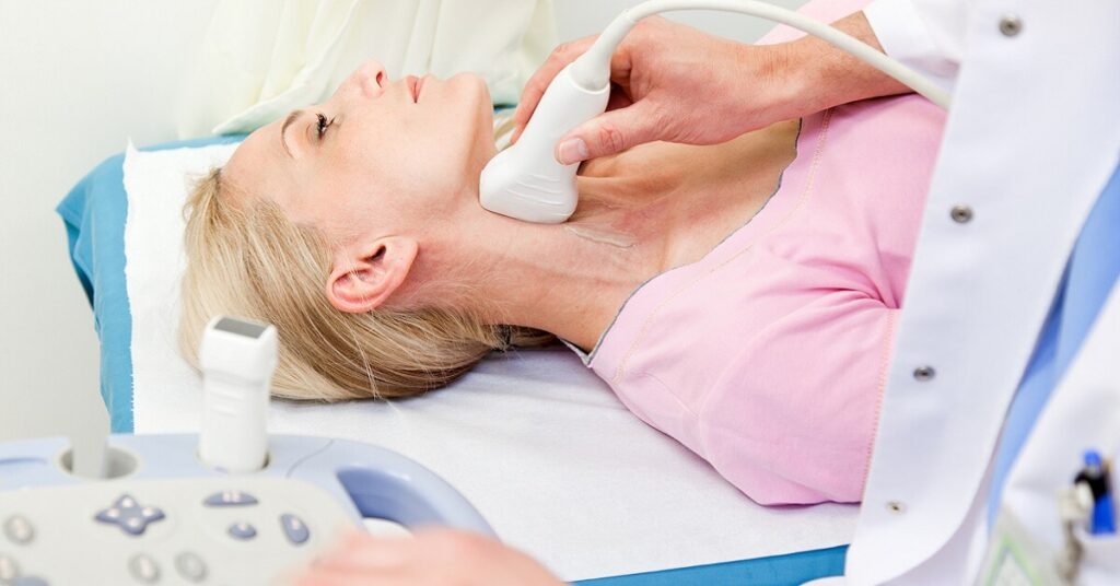 life expectancy with blocked carotid artery